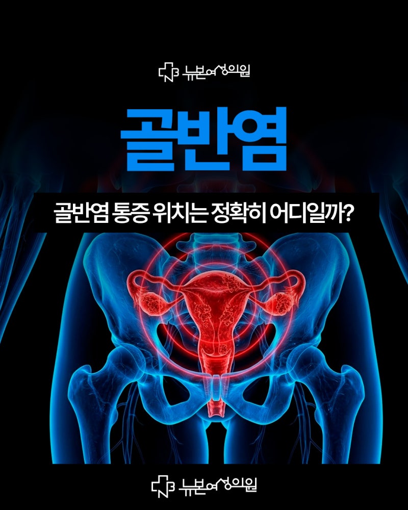 하단골반염 통증 위치는 정확히 어디일까?부위별 증상 자가 체크 사진 2