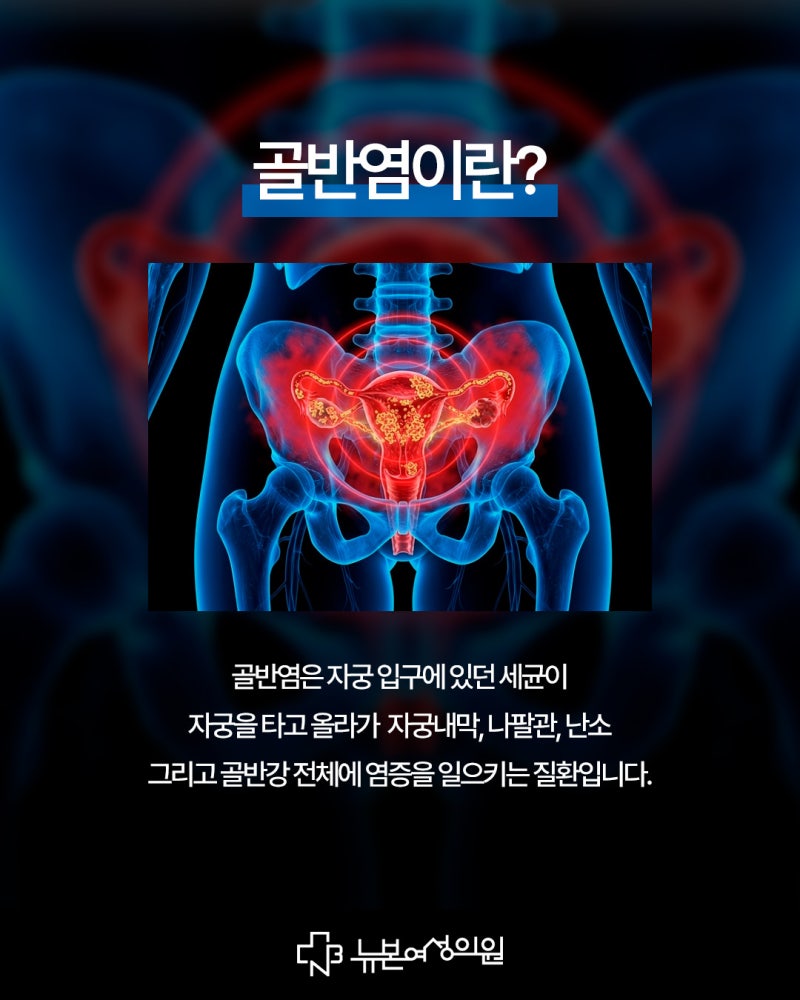 하단골반염 통증 위치는 정확히 어디일까?부위별 증상 자가 체크 사진 3