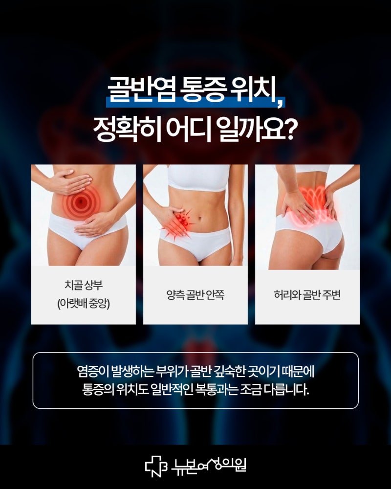 하단골반염 통증 위치는 정확히 어디일까?부위별 증상 자가 체크 사진 4