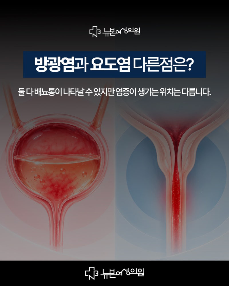 하단방광염,요도염과 어떻게 다를까요?