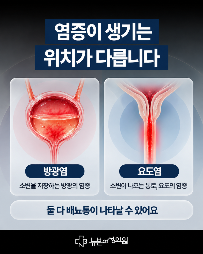 하단방광염,요도염과 어떻게 다를까요? 사진 2